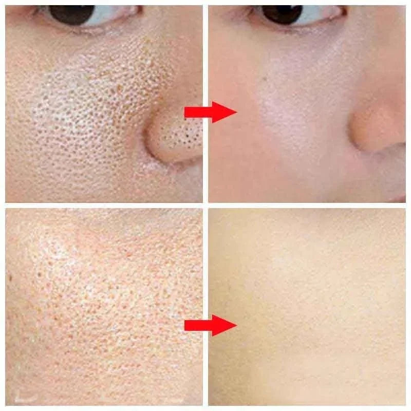 Pore Refining Serum cleansing the face